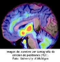 TEP